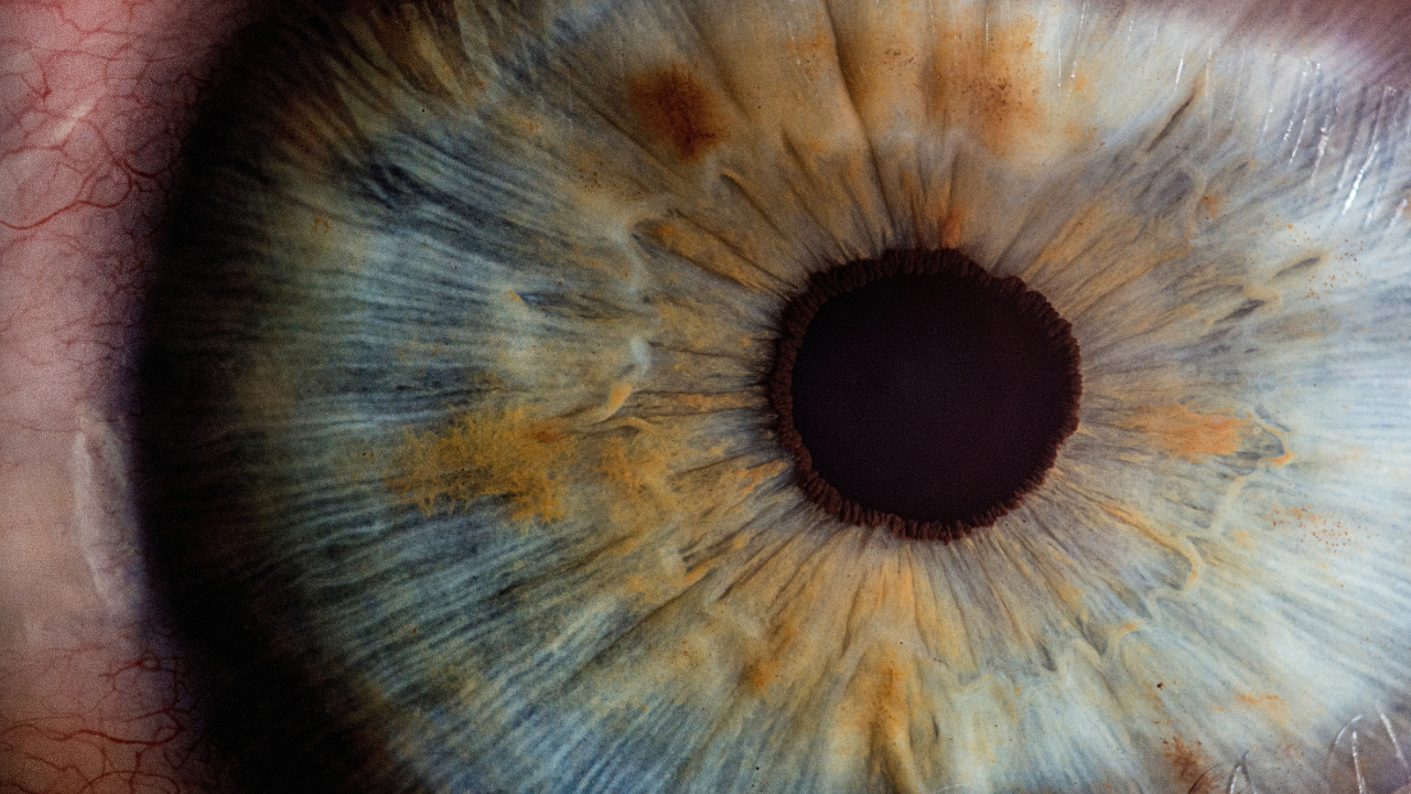 Iridology
